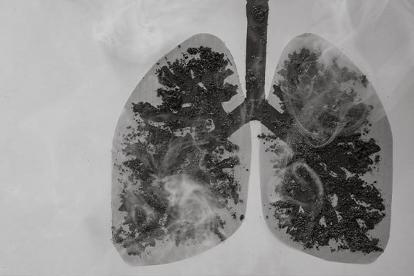 Dust or Fume Exposure